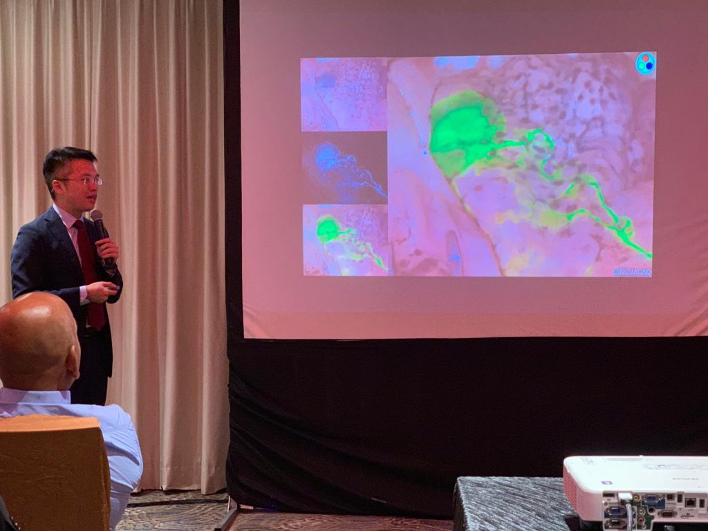 Dinner Symposium:

Fluorescence-guided Pulmonary Segmentectomy and Nodule Detection