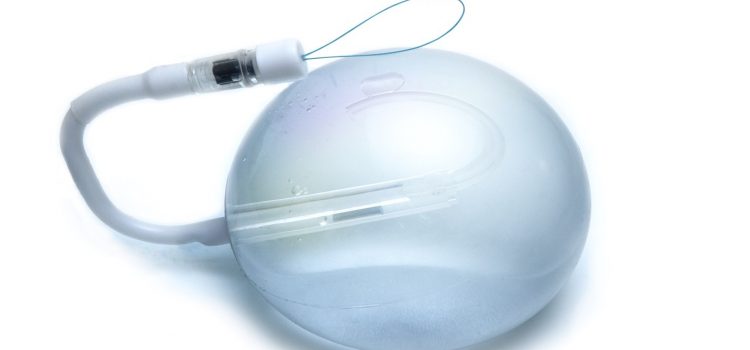 Spatz3 Gastric Balloon – A Non-Surgical Approach to Weight Loss