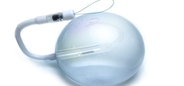 Spatz3 Gastric Balloon – A Non-Surgical Approach to Weight Loss Spatz3 Gastric Balloon – A Non-Surgical Approach to Weight Loss